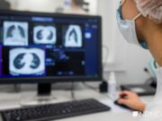 Врач прокомментировал исследование о пользе чая и кофе в борьбе с деменцией